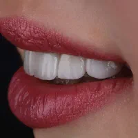 آموزش دندان متحرک (دندانسازی)