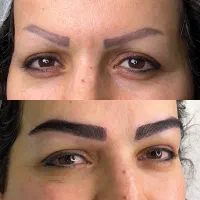 کاشت ابرو رشت فقط با ۱۲میلیون تومان