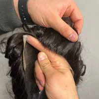 کاشت مو به روش پروتزمو|خدمات آرایشگری و زیبایی|شیراز, قدوسی شرقی|دیوار