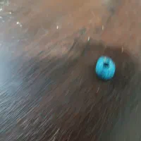 سنگ چشم زخم