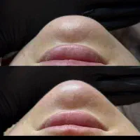 تزریق ژل،بوتاکس درمکانی مستقل بارعایت اصول بهداشتی|خدمات آرایشگری و زیبایی|زاهدان, |دیوار