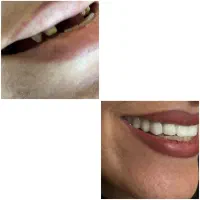 کامپوزیت خرم اباد|خدمات آرایشگری و زیبایی|بروجرد, |دیوار