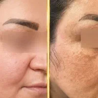 ضد آفتاب، شوینده
