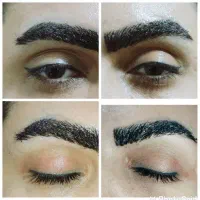 پاک کردن تتو(ریموو تتو)|خدمات آرایشگری و زیبایی|کرمانشاه, |دیوار