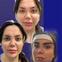 کاشت ابرو ومو به روش شیرازی نهایت دقت و سرعت|خدمات آرایشگری و زیبایی|تهران, تهرانپارس غربی|دیوار