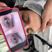 ریموو ابرو تخصصی زیر نظر الهام عباسیان