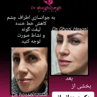 پکیج جوانساز