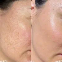 مرکز تخصصی فیلر بادی (فرم دهی بدن و زیبایی اندام)|خدمات آرایشگری و زیبایی|تهران, تهرانسر شرقی|دیوار