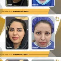 تور خدمات و جراحی زیبایی|خدمات آرایشگری و زیبایی|گرگان, |دیوار