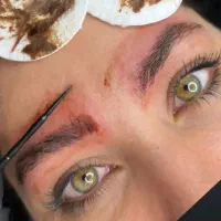 ریموو  تخصصی