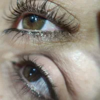 لیفت و بوتاکس مژه و ابرو