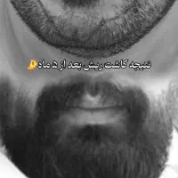 کاشت مو یا معجزه.محیط VIP،تیم شیراز در یزد(تضمینی)