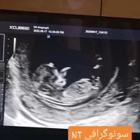 دستگاه سونوگرافی