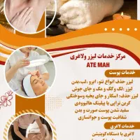 لیزر لک و لیزر کربن تراپی لاغری با کویتیشن و اراف