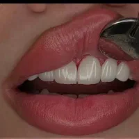 دندانپزشکی/کاریزماتوکویاما/فکی۱۵۱۶کامپوزیت/عصبکشی