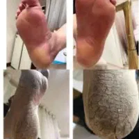 پدیکور و پاکسازی|خدمات آرایشگری و زیبایی|تربت‌حیدریه, شهید قرنی|دیوار