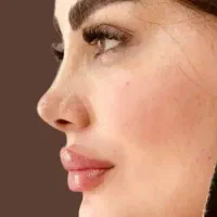 لیفت صورت ،شقیقه،گونه ،جراحی بینی ،تخفیف تابستان|خدمات زیبایی و سلامت|تهران, ونک|دیوار