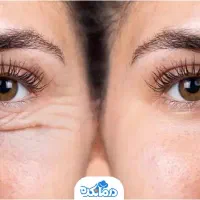 جراح بلفارو در رشت