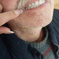 ساخت دندان مصنوعی|پزشکی|سنندج, |دیوار