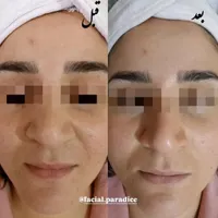 آموزش و پاکسازی و فیشیال تخصصی پوست|خدمات آرایشگری و زیبایی|مشهد, فارغ التحصیلان|دیوار