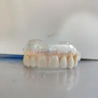 دندانسازی و دندان مصنوعی|خدمات آرایشگری و زیبایی|تبریز, |دیوار