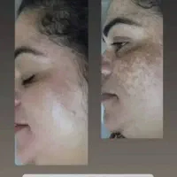 کرم ضدلک لاکچری کوین اصل نمایندگی کوثر|آرایشی، بهداشتی، درمانی|کوثر, |دیوار