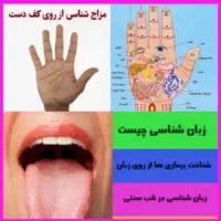 درمان وکاردرزمینه طب سنتی