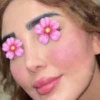 مدل ژل و بوتاکس