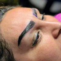 آموزش تخصصی کاشت مو