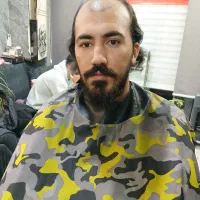 پروتز مو وارداتی درجه یک