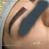 کاشت مو، کاشت ابرو، بلفارو، عمل بینی، غبغب