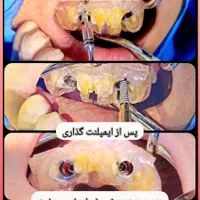 مجموعه دندانپزشک ماهر(ارزون و بی کیفیت نیستیم)|خدمات آرایشگری و زیبایی|زاهدان, |دیوار