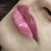 ژل ـ لب ـ گونه و... بوتاکس. آنزیم|خدمات آرایشگری و زیبایی|قم, تولید دارو و یخچال|دیوار