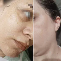 پوست و مو سالم وبدون چروک با پک مراقبتی