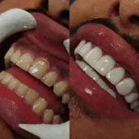 دندانپزشکی