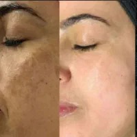 محصولات کرش پسند کرم سفید کننده