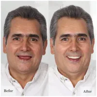 مرکزتخصصی ایمپلنت/شرایط‌اقساطی‌ویژه