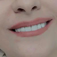 کامپوزیت زیبایی دندان( مدل) فقط توسط دندانپزشک|خدمات آرایشگری و زیبایی|تهران, صادقیه|دیوار