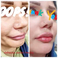 کامپوزیت دندان ژل و بوتاکس پی آرپی و لیفت نخ|خدمات آرایشگری و زیبایی|اهواز, نادری|دیوار