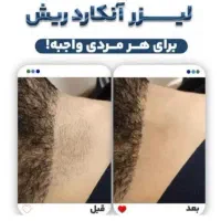 آموزش مرکز لیزر مو طول موج کندلا لیزر بانوان لیزر|خدمات آموزشی|اصفهان, خواجو|دیوار