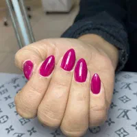 ترمیم و کاشت با شقایق