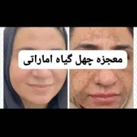 کرم معجزه 43ترکیبه عماراتی|آرایشی، بهداشتی، درمانی|شیراز, سلطان آباد|دیوار
