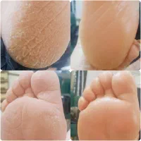 پدیکور و کفسابی پا|خدمات آرایشگری و زیبایی|شاهینشهر, خانه کارگر|دیوار