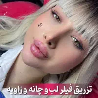 ژل لب گونه گونه زاویه فک و بوتاکس ۲۹۹ تا آخر هفته