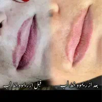 پاک کردن و ریموو تتو ابرو چشم لب ۱۰۰٪ تضمینی|خدمات آرایشگری و زیبایی|یاسوج, |دیوار