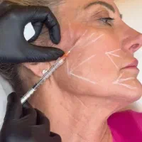 آموزش تخصصی فیلر و بوتاکس