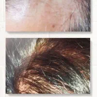 محصولات شرکت نیوشانیک|آرایشی، بهداشتی، درمانی|تهران, شهرک امام خمینی|دیوار