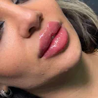 کلینیک تزریق ژل بوتاکس آنزیم فیلر لب شقیقه|خدمات آرایشگری و زیبایی|کرج, گوهردشت|دیوار