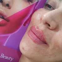 تزریق ژل و بوتاکس و هایفوتراپی پروفایلو فیلر بادی|خدمات آرایشگری و زیبایی|شیراز, فرهنگ شهر|دیوار