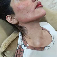 خدمات ژل و بوتاکس|خدمات آرایشگری و زیبایی|شیراز, نصرآباد|دیوار